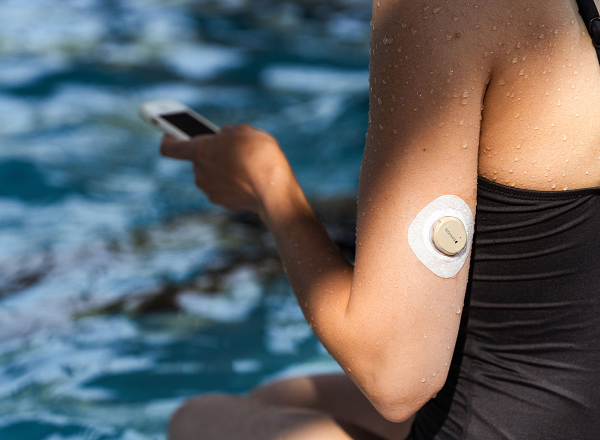 Continuous Glucose Monitoring Reveals Unique Metabolic Patterns